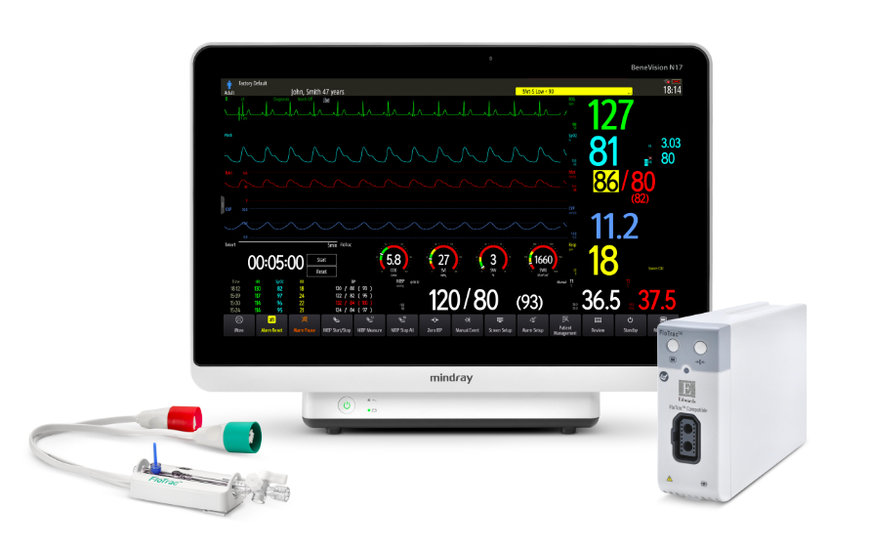 MINDRAY LAUNCHES ADVANCED HEMODYNAMIC MONITORING SOLUTION